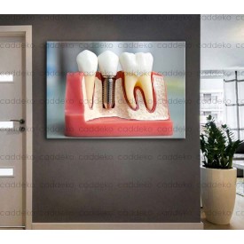 Ağız ve Diş Polikliniği, Dişçi Tabloları Dekoratif Diş, Dekoratif Dişçi, Dişçi Dekorasyonu dsc187