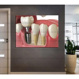 Ağız ve Diş Polikliniği, Dişçi Tabloları Dekoratif Diş, Dekoratif Dişçi, Dişçi Dekorasyonu dsc207